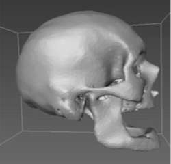 Study: CT scans could bolster forensic database to ID unidentified remains