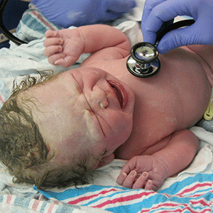 Study to evaluate timing of pushing on C-section rates, birth complications