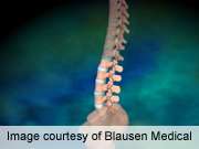 Surgeon type doesn't affect spinal surgery complications