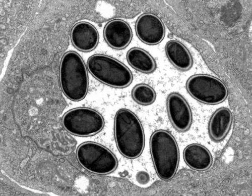 Swiss scientists explain evolution of extreme parasites