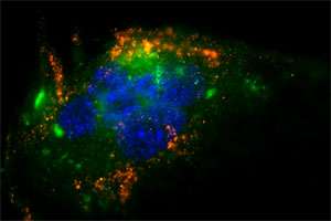 Targeting cancer cells with nanoparticles
