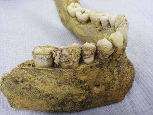 Team discovers first evidence of milk consumption in ancient dental plaque