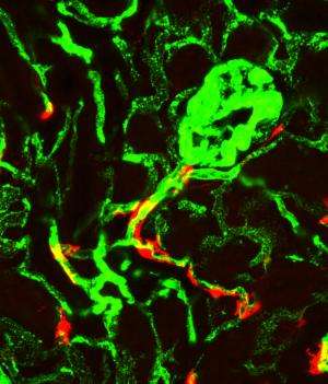 The cellular origin of fibrosis