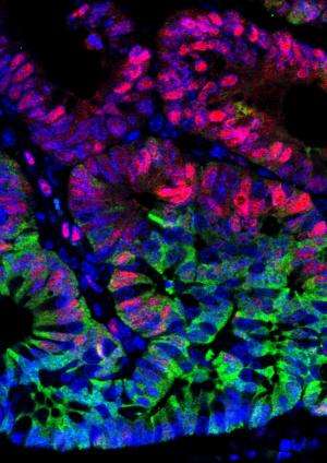 The colon has a safety mechanism that restricts tumor formation