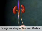 Thiazide prophylaxis for kidney stones doesn't increase DM risk