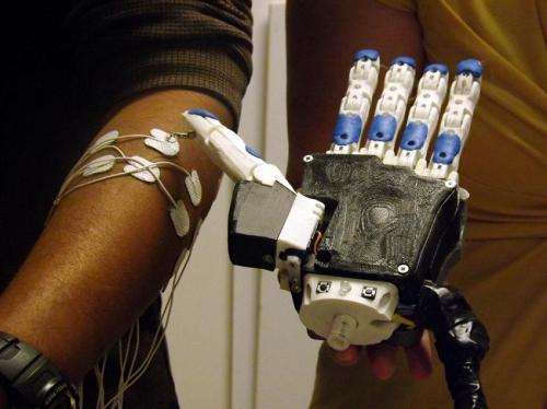 Through 3D-printed prosthetic, Illinois students lending a hand in Ecuador