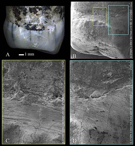 Tooth-picking behavior identified in the middle Pleistocene hominins of Eastern China