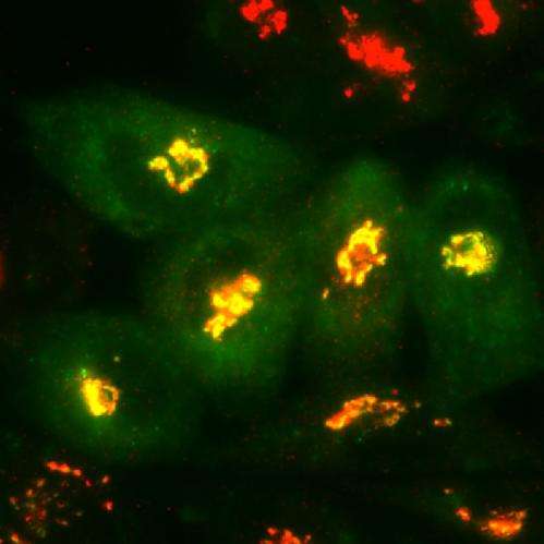 Scientists slow development of Alzheimer's trademark cell-killing plaques