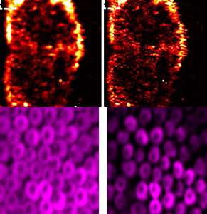 Unwanted side effect becomes advantage in photoacoustic imaging