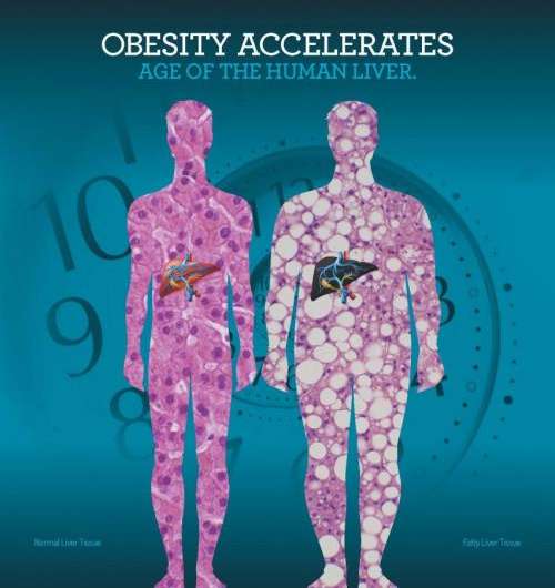 Using a novel biological aging clock, UCLA researchers find obesity accelerates aging of the liver