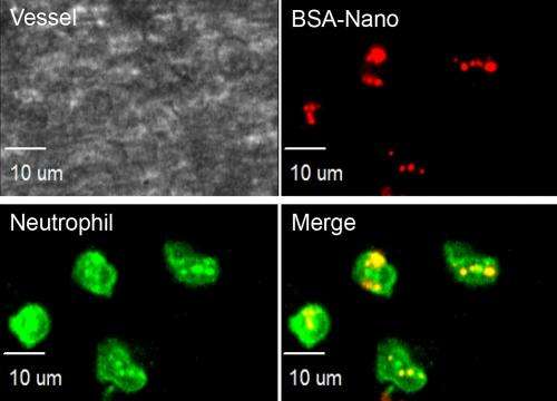 Nanoparticles target anti-inflammatory drugs where needed