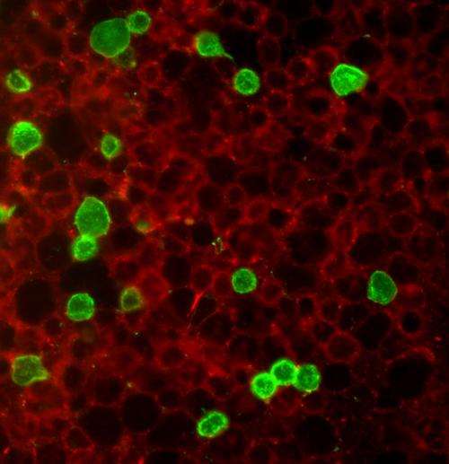 U.Va. researchers identify novel cell type that leads to aggressive leukemia