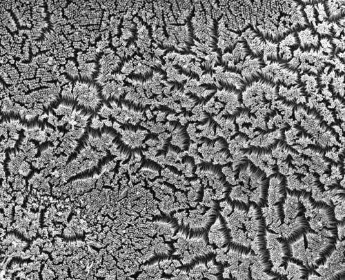 Vanderbilt researchers discover how intestinal cells build nutrient-absorbing surface