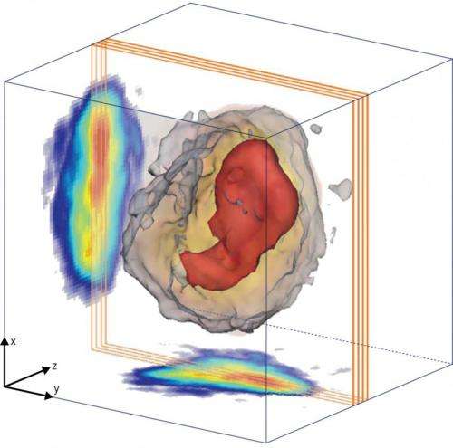 X-ray imaging reveals a complex core