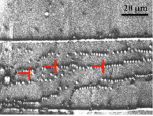 X-ray topography of threading dislocations in aluminum nitride