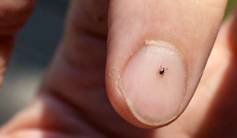 耶鲁研究人员识别新蜱传染的程度