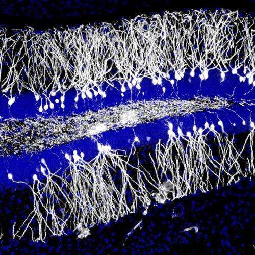 Study of neurogenesis in mice may have solved mystery of childhood amnesia in humans