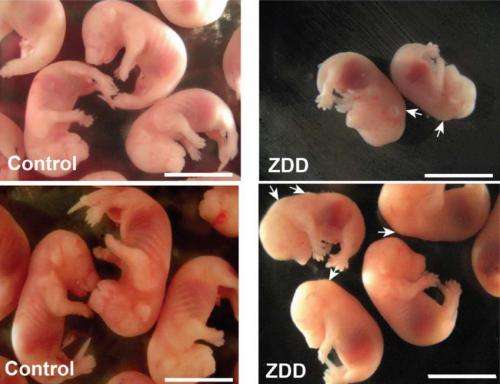 Zinc deficiency before conception disrupts fetal development