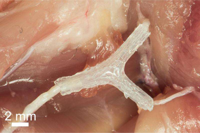 3-D printed guide helps regrow complex nerves after injury