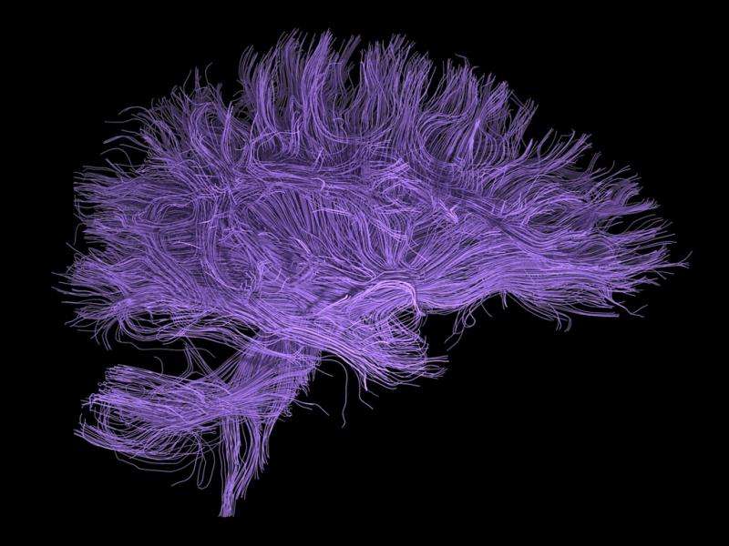 After years of conflict, huge project could help scientists decipher the brain