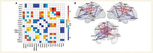 Autistic and non-autistic brain differences isolated for first time