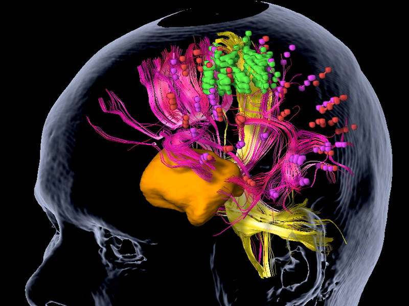 Brain tumors: Millimeter by millimeter towards a better prognosis