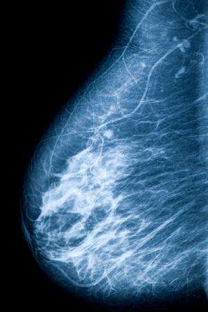 Breast cancer research shapes prevention policy with leading US health body
