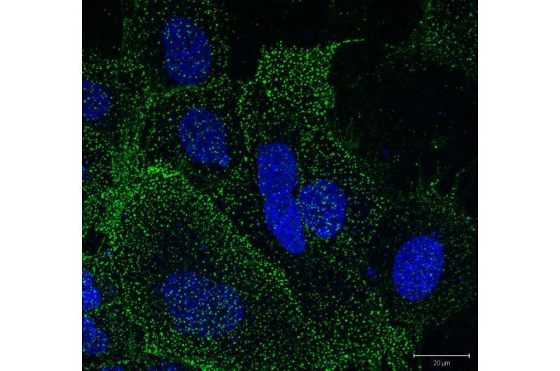 Cell surface discovery may lead to major breakthrough in cancer treatment