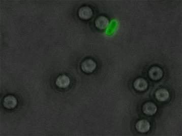 Concentrating pathogenic bacteria accelerates their detection