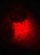 Detecting lysosomal pH with fluorescent probes