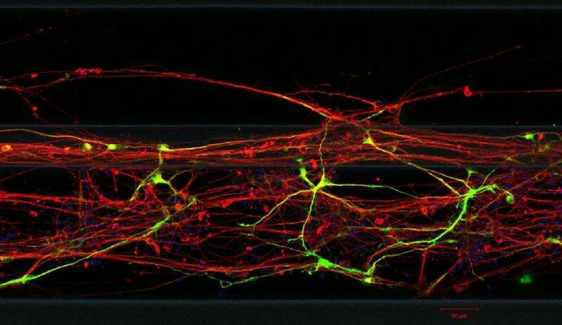 Drug discovery for Parkinson's disease: LCSB researchers grow neurons in 3-D