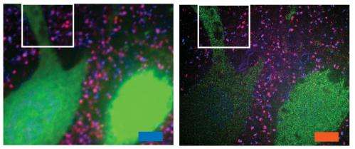 Engineers enlarge brain tissue to study nanoscale features
