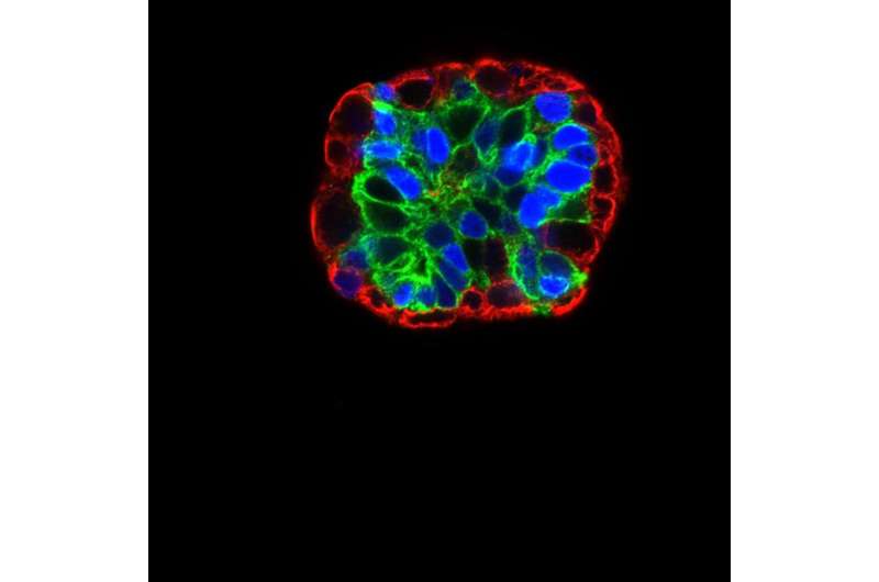 Errant gene turns cells into mobile cancer factories