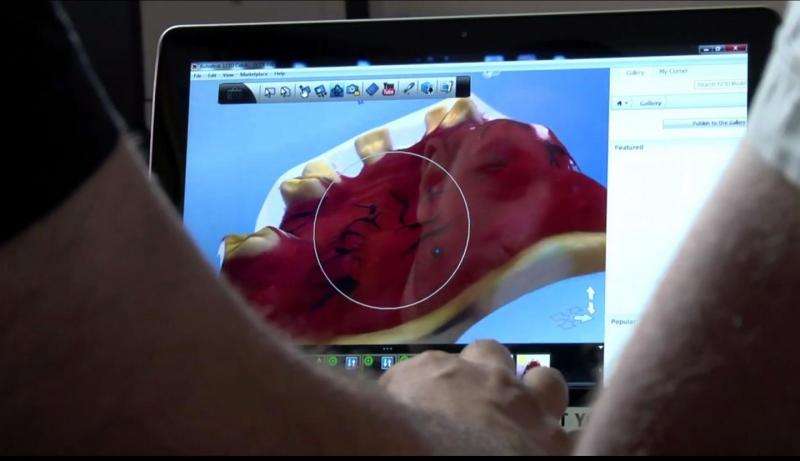 From 30 days to 30 minutes: 3-D digital scanning shortens denture-fitting time