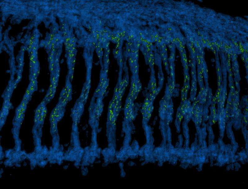 Fruit fly studies shed light on adaptability of nerve cells