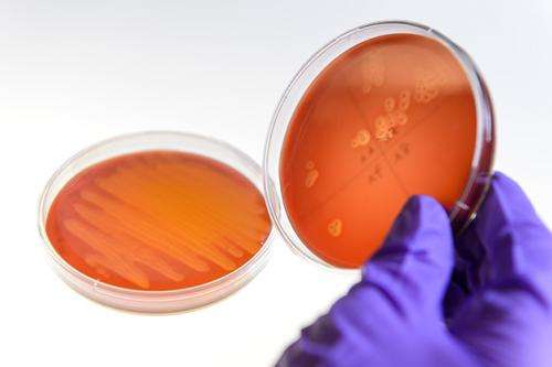 Getting ahead of antibiotic-resistant bacteria