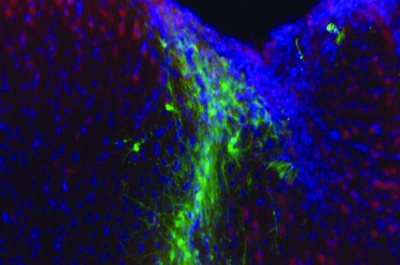 'Hydrogels' boost ability of stem cells to restore eyesight and heal brains