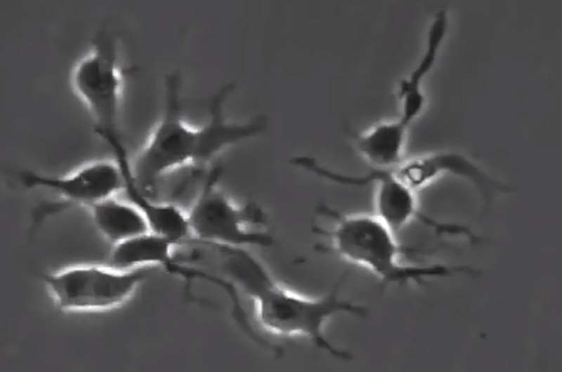 Image-tracking technology allows scientists to observe nature vs. nurture in neural stem cells