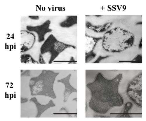 Microbes scared to death by virus presence