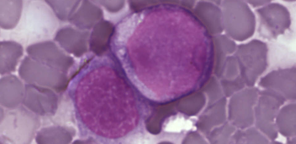 New microscopic imaging technology reveals origins of leukaemia