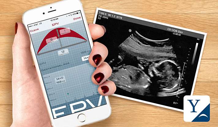 New Yale ResearchKit app aims to prevent pregnancy loss