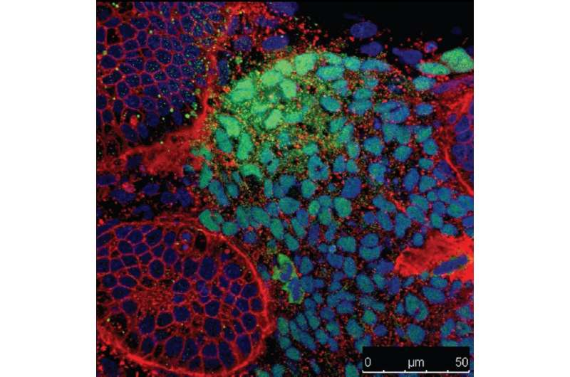 Novel stem cell line avoids risk of introducing transplanted tumors