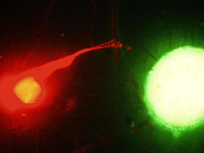 科学家观察神经和癌细胞之间的致命舞蹈