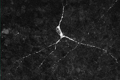 科学家生产下丘脑神经元，可以帮助瞄准一系列条件