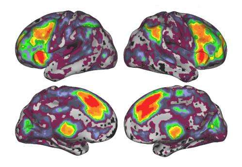 Study documents scale of error-based brain activity