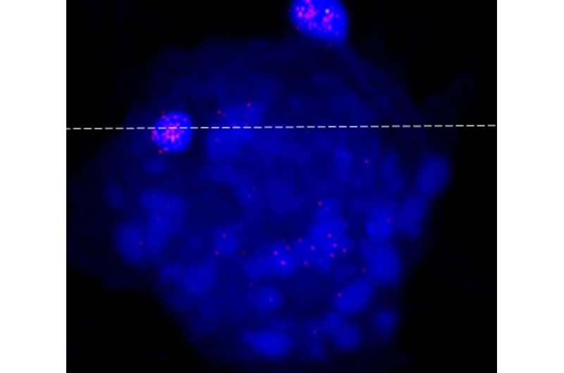 Study shows algae virus can infiltrate mammalian cells