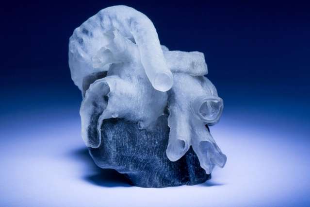 System can convert MRI heart scans into 3D-printed, physical models in a few hours
