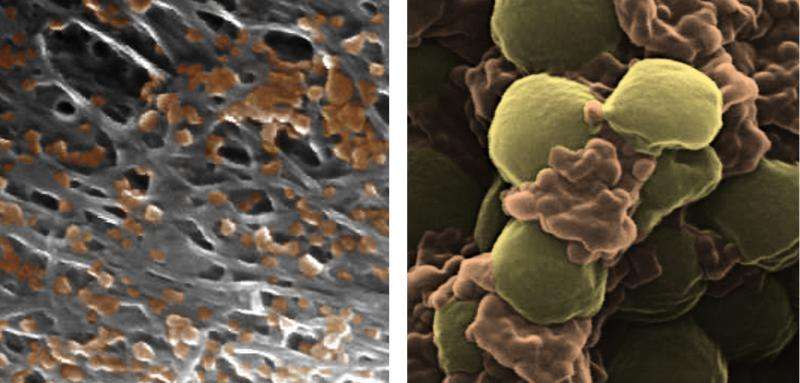Targeted drug delivery with these nanoparticles can make medicines more effective