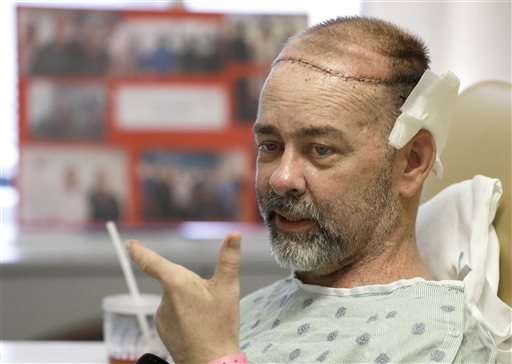 Texas doctors do first skull and scalp transplant