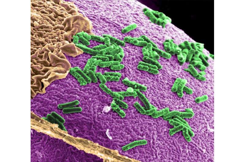 New research finds balance between ‘good’ and ‘bad’ bacteria in humans altered